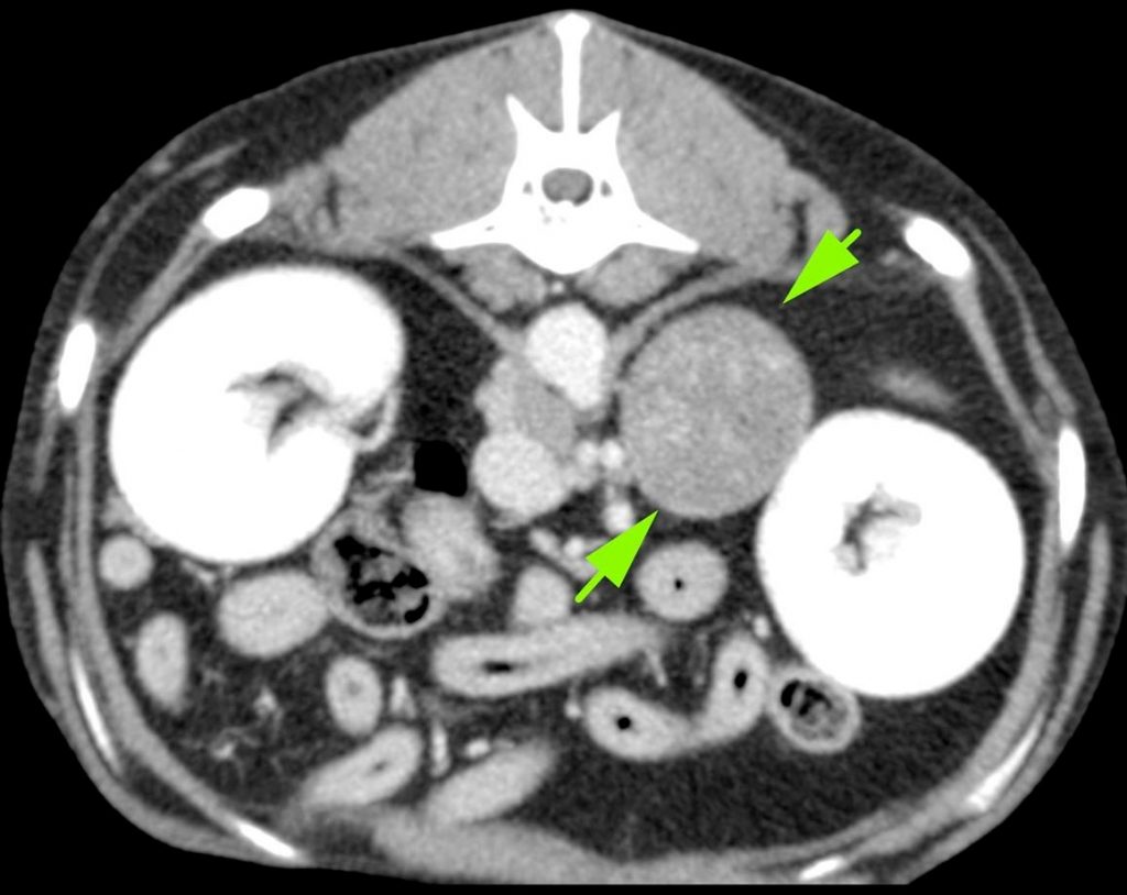 ct scan cross section