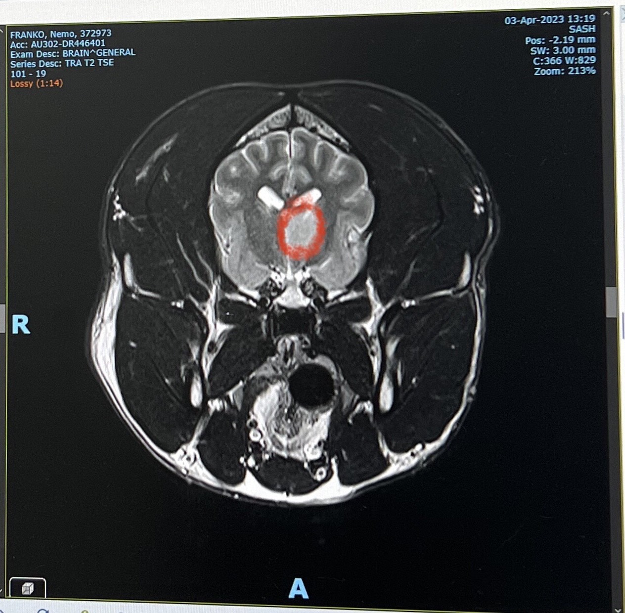Nemo's MRI scan