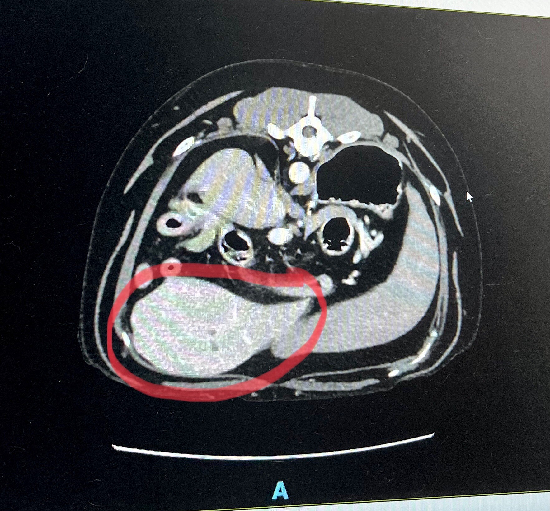 Nemo's CT scan
